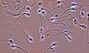Sperm under microscope.