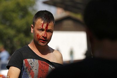 Migrant injured after clash. Click to enlarge