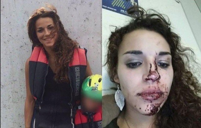 before and after