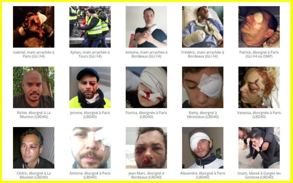 Record of some of the appalling injuries inflicted upon unarmed civilians by police forces across France. Click to enlarge
