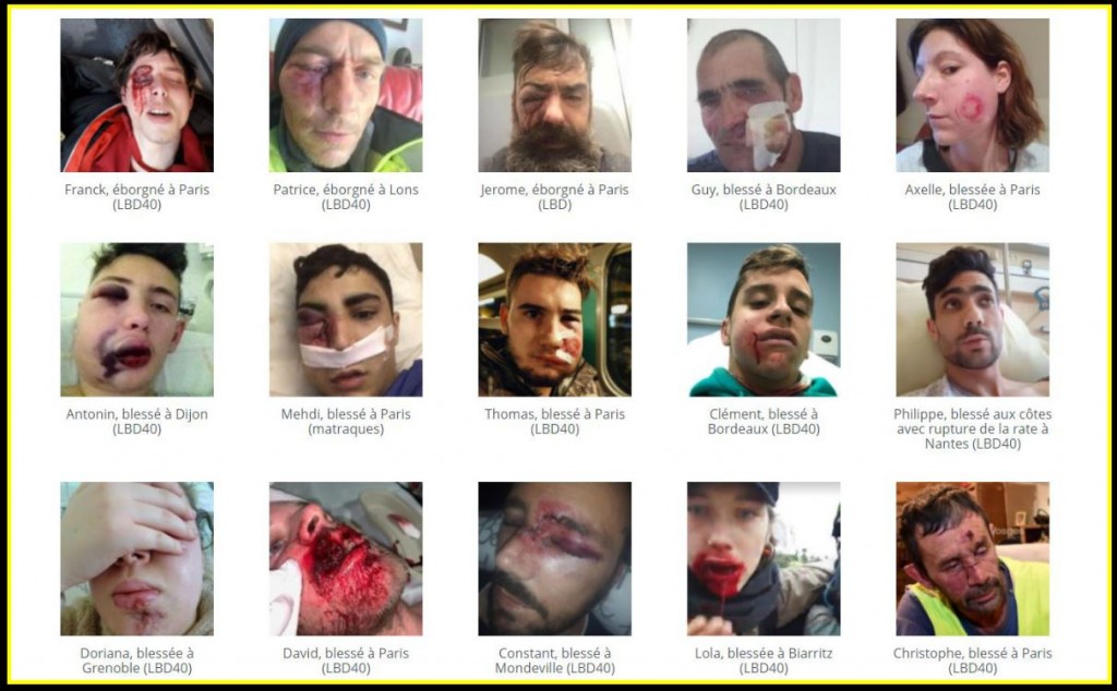 Record of injuries from police use of disproportionate force against unarmed civilians during GJ protests. Click to enlarge