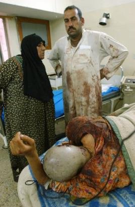 A wounded Iraqi girl Monday April,7. 2003 lays in a in hospital bed after being brought by her family to one of Baghdad's surgery hospital. The girl was wounded during a coalition attack on the al-Rashidiya area in the outskirts of Baghdad. (AP Photo/Ali Haider).